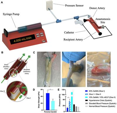 Using extracellular matrix as the bio-glue for wound repair in the surgery